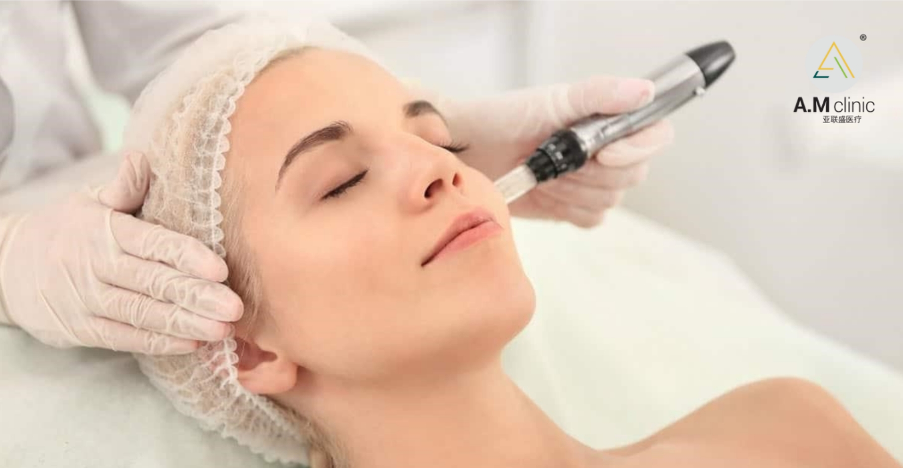 AM Micro-Needling
